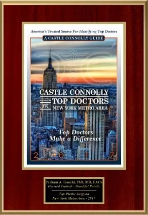 New York Area Top Doctor 2017