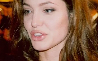 Has Angelina Jolie Had a Celebrity Nose Job or Other Plastic Surgery?